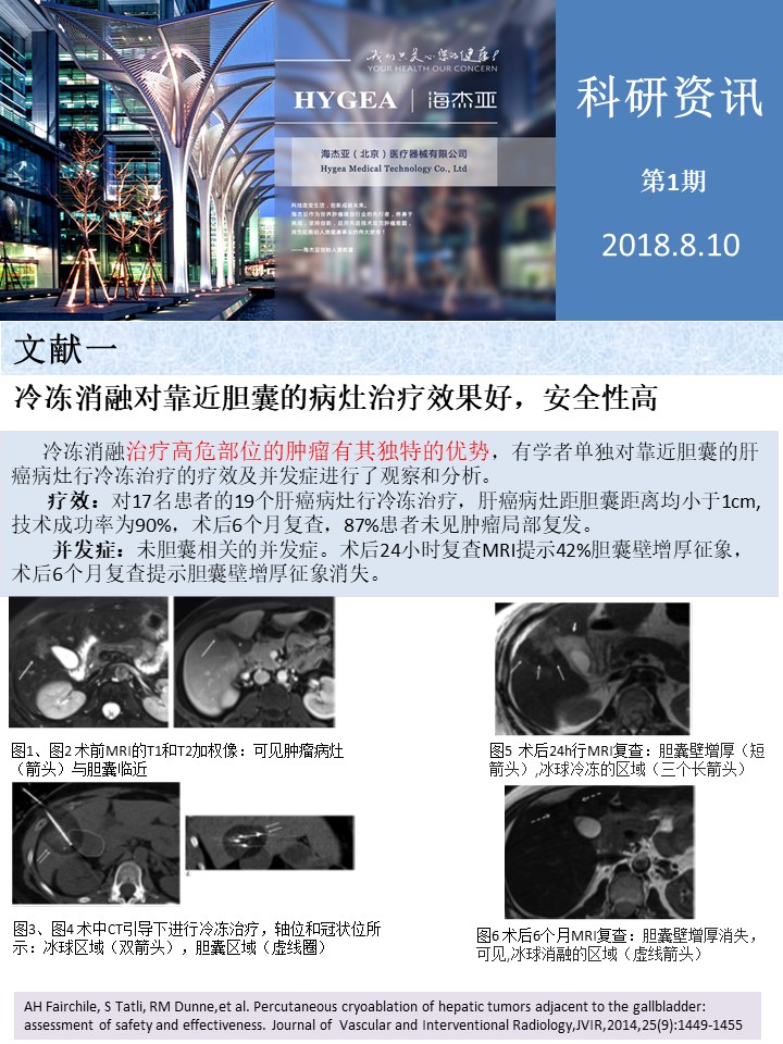 【海杰亞科研資訊】第1期——肝、肺癌消融