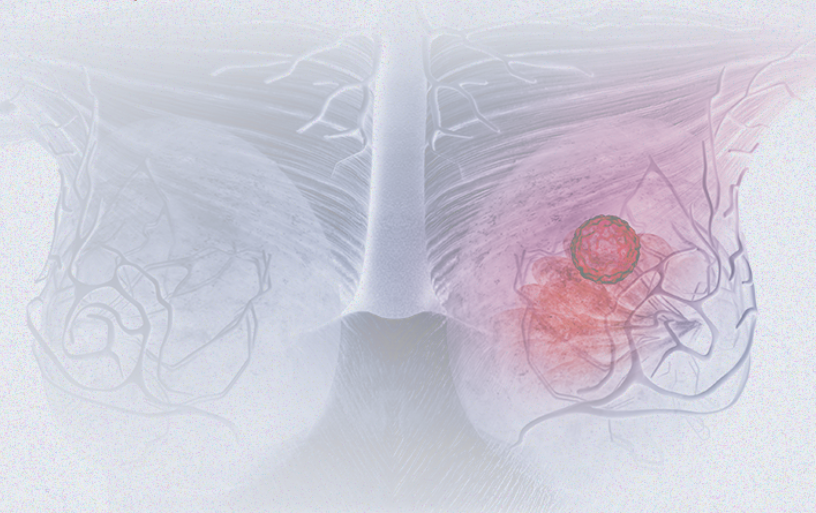 國際婦女節 | 關注乳腺癌 微創介入讓美麗繼續,「乳」愿以償正成為現實